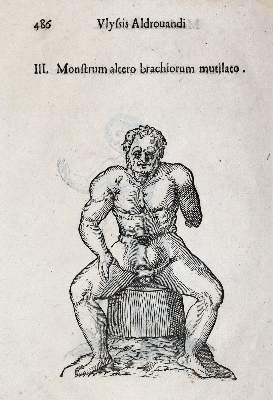 Bild Nr.4: 142-1879 Aldrovandi,U.: (Medizin)