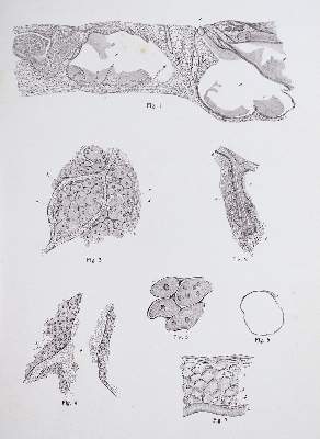Bild Nr.2: 142-1882 Vincentiis,C.de.: (Medizin, Augenheilkunde)
