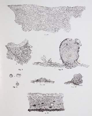 Bild Nr.3: 142-1882 Vincentiis,C.de.: (Medizin, Augenheilkunde)