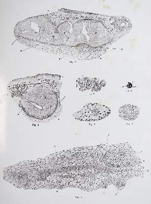 Bild Nr.4: 142-1882 Vincentiis,C.de.: (Medizin, Augenheilkunde)