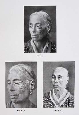 Bild Nr.5: 142-1882 Vincentiis,C.de.: (Medizin, Augenheilkunde)