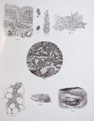 Bild Nr.6: 142-1882 Vincentiis,C.de.: (Medizin, Augenheilkunde)