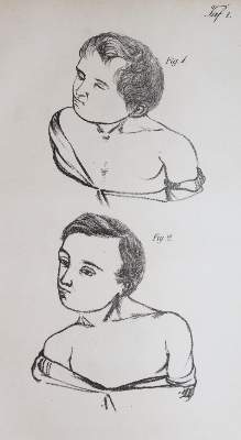 Bild Nr.2: 142-1900 Dieffenbach,J.F.: (Medizin)