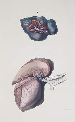 Bild Nr.1: 142-1938 Reisseisen,F.D.: (Medizin)