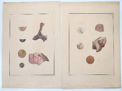 Bild Nr.221: 142-1938 Reisseisen,F.D.: (Medizin)