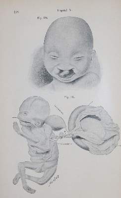 Bild Nr.4: 142-1943 Sammlung: (Medizin)