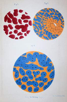Bild Nr.2: 142-1944 Sammlung: (Medizin)