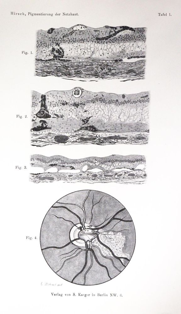 Große Abbildung Nr.3: 143-1822 Sammlung: (Medizin, Augenheilkunde)
