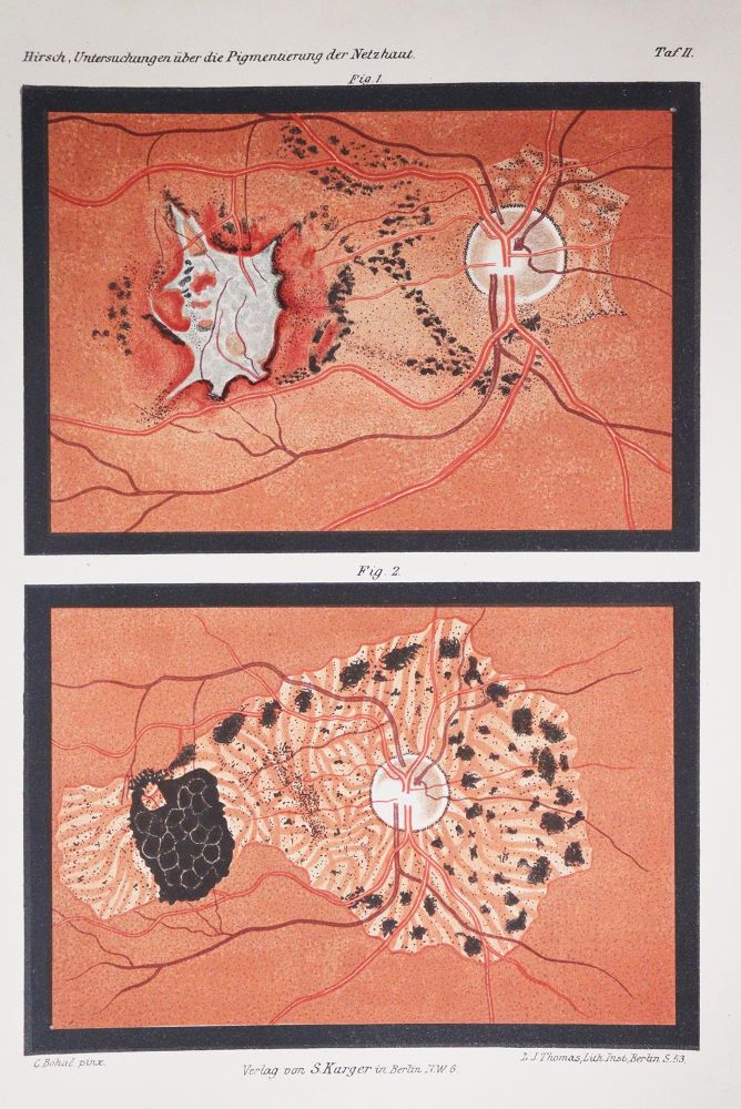 Große Abbildung Nr.4: 143-1822 Sammlung: (Medizin, Augenheilkunde)