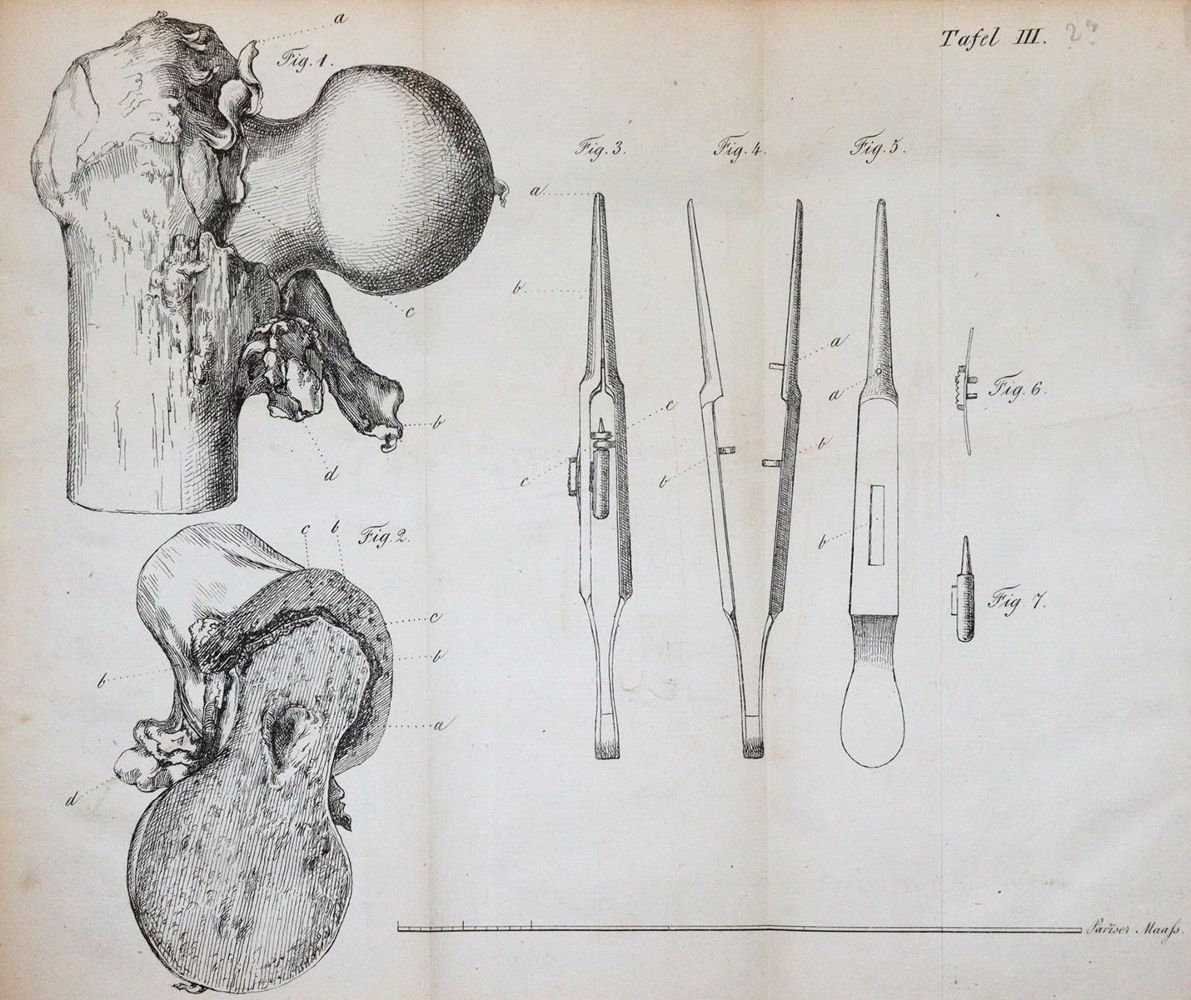 Große Abbildung Nr.5: 143-1833 Fricke,J.C.G.: (Medizin)