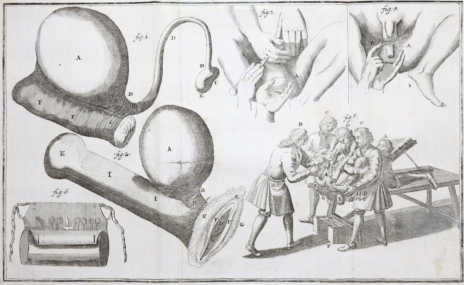 Große Abbildung Nr.2: 143-1835 Heister,L.: (Medizin)