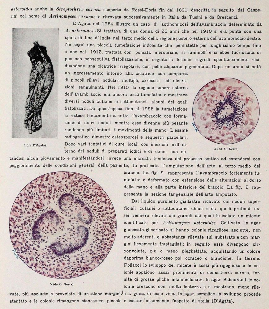 Große Abbildung Nr.3: 143-1851 Pollacci,G. u. A.Nannizzi.: (Medizin)