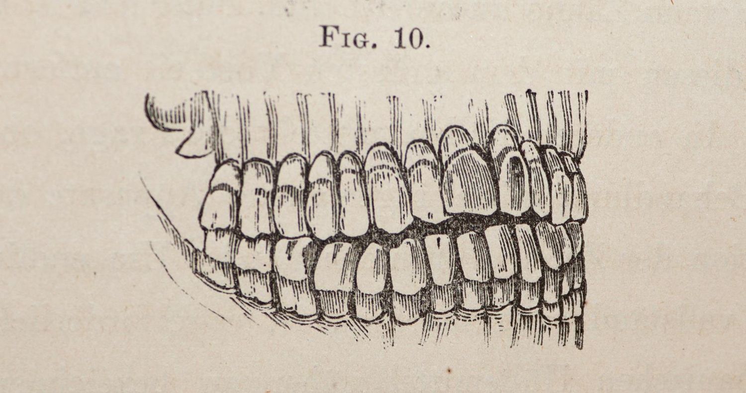 Große Abbildung Nr.2: 143-1859 Sewill,H.: (Medizin, Zahnheilkunde)