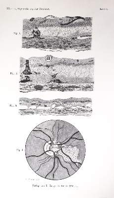 Bild Nr.3: 143-1822 Sammlung: (Medizin, Augenheilkunde)