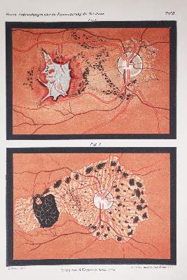 Bild Nr.4: 143-1822 Sammlung: (Medizin, Augenheilkunde)