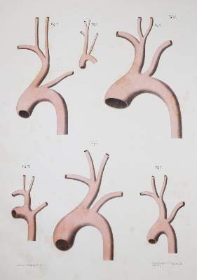Bild Nr.2: 143-1826 Barkow,H.C.L.: (Medizin)