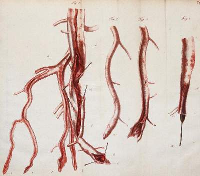 Bild Nr.4: 143-1833 Fricke,J.C.G.: (Medizin)