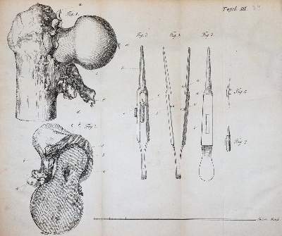 Bild Nr.5: 143-1833 Fricke,J.C.G.: (Medizin)