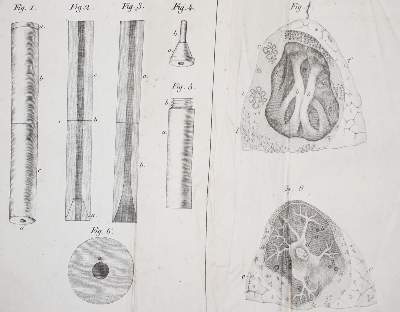 Bild Nr.2: 143-1845 Laennec,R.T.H.: (Medizin)