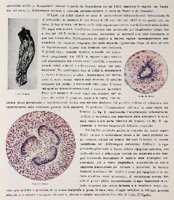 Bild Nr.3: 143-1851 Pollacci,G. u. A.Nannizzi.: (Medizin)