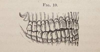 Bild Nr.2: 143-1859 Sewill,H.: (Medizin, Zahnheilkunde)