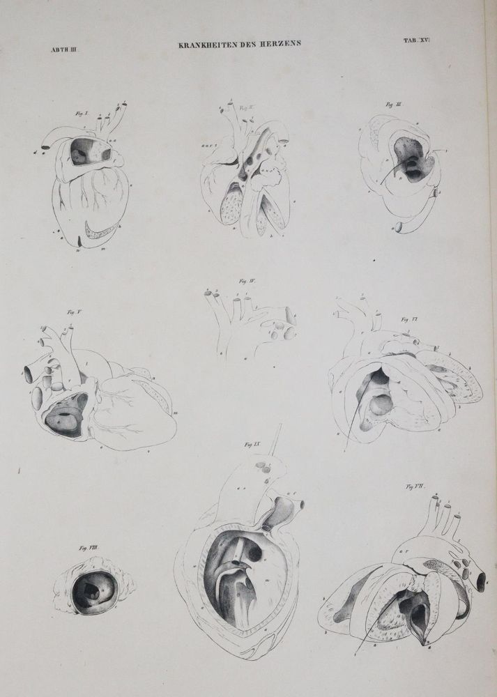 Große Abbildung Nr.3: 144-1334 Albers,J.F.H.: (Medizin)