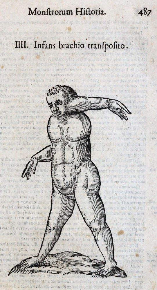 Große Abbildung Nr.2: 144-1335 Aldrovandi,U.: (Medizin)