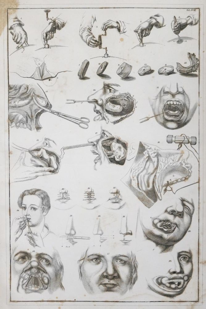 Große Abbildung Nr.4: 144-1347 Blasius,E.: (Medizin)