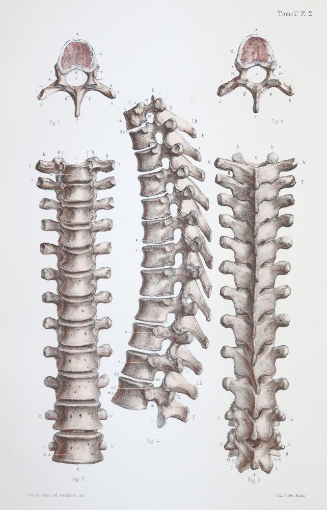 Große Abbildung Nr.1: 144-1349 Bonamy,C. u. P.Broca.: (Medizin)