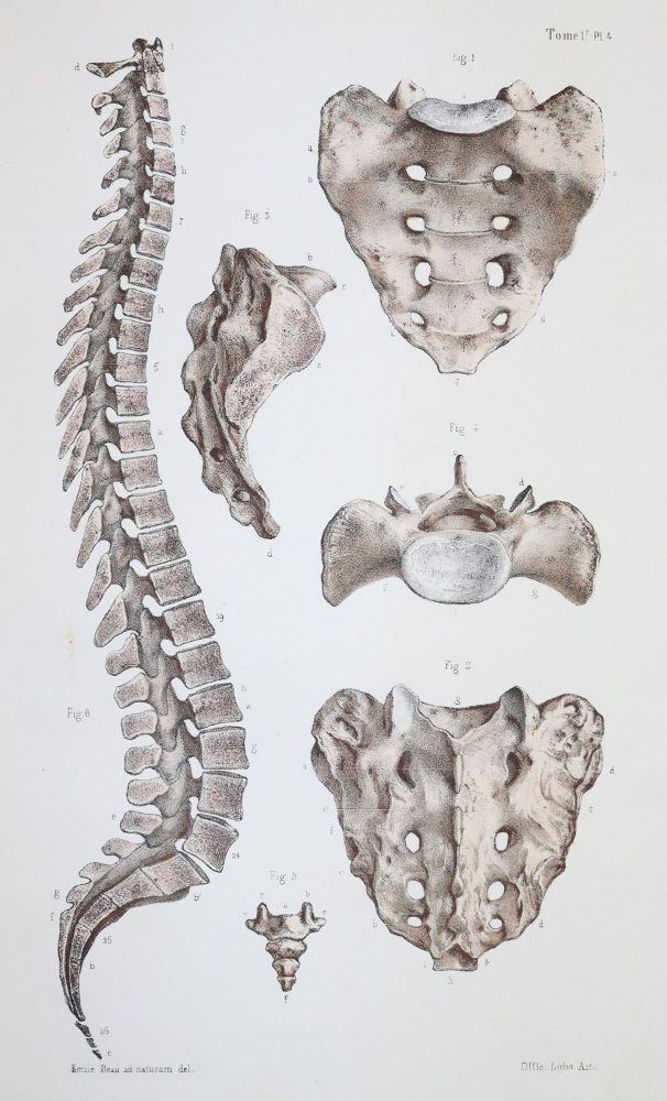 Große Abbildung Nr.2: 144-1349 Bonamy,C. u. P.Broca.: (Medizin)