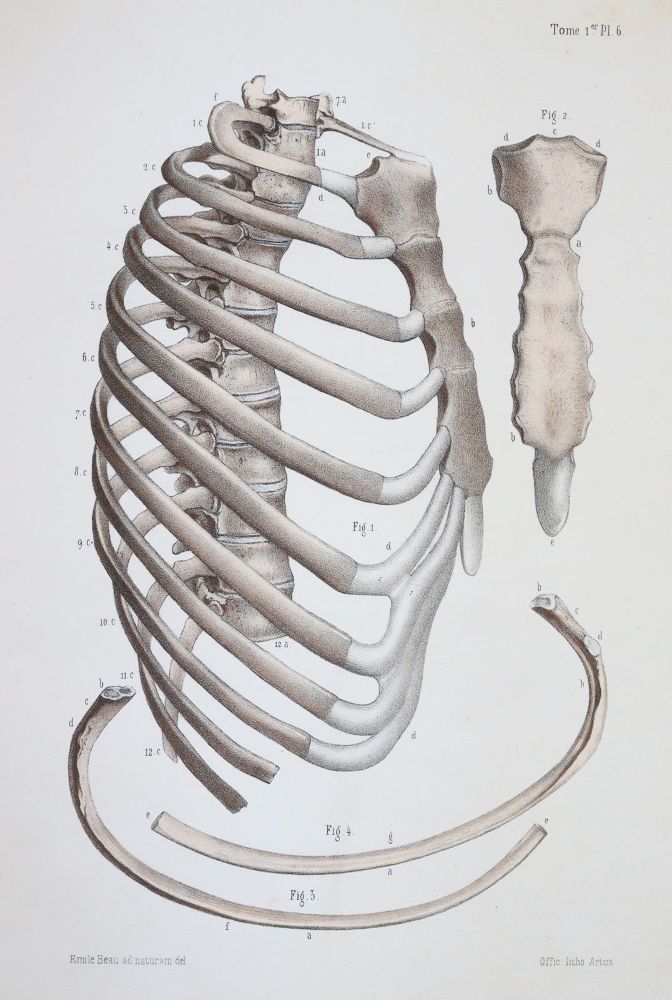 Große Abbildung Nr.3: 144-1349 Bonamy,C. u. P.Broca.: (Medizin)