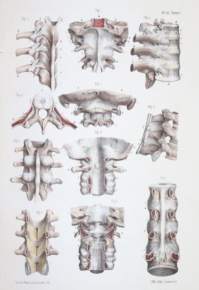 Große Abbildung Nr.4: 144-1349 Bonamy,C. u. P.Broca.: (Medizin)