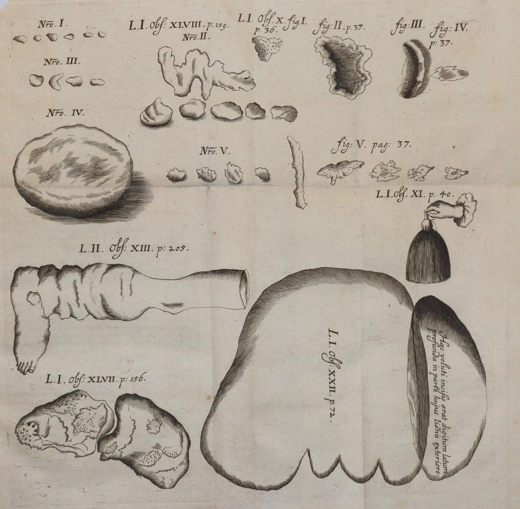 Große Abbildung Nr.2: 144-1358 Wolf,I.: (Medizin, Chirurgie)