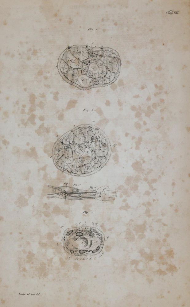 Große Abbildung Nr.4: 144-1365 Froriep,R.: (Medizin)