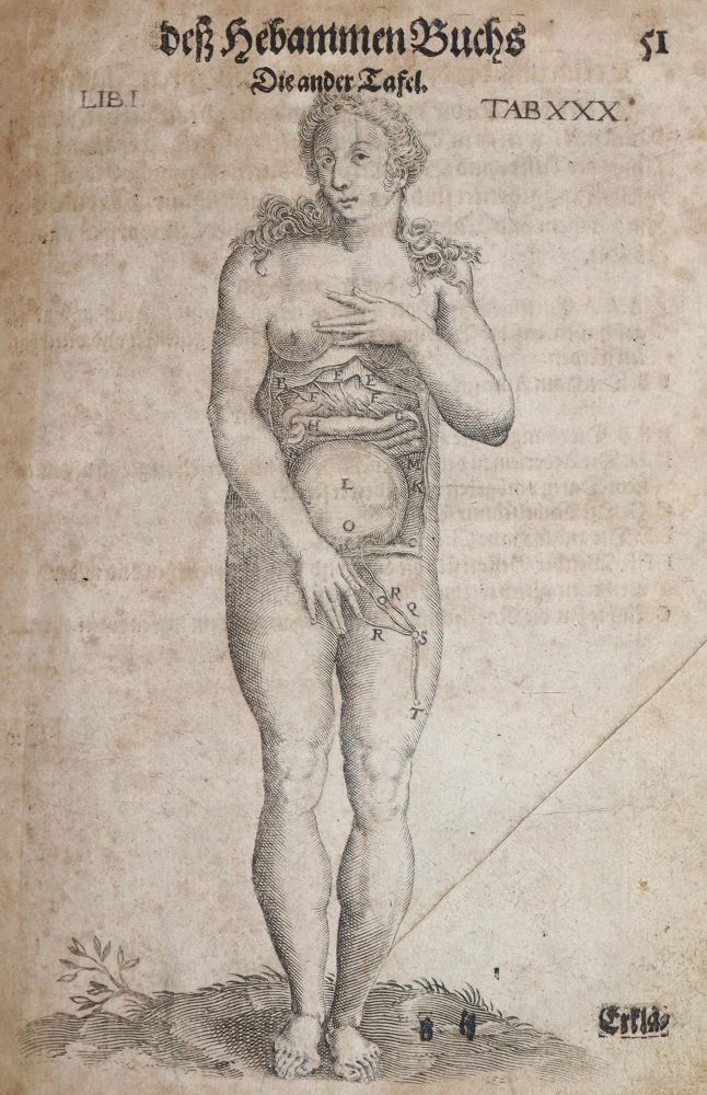 Große Abbildung Nr.1: 144-1369 Bourgeois,L.: (Medizin, Gynäkologie)