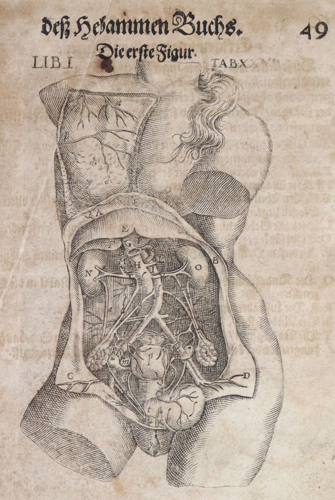 Große Abbildung Nr.2: 144-1369 Bourgeois,L.: (Medizin, Gynäkologie)