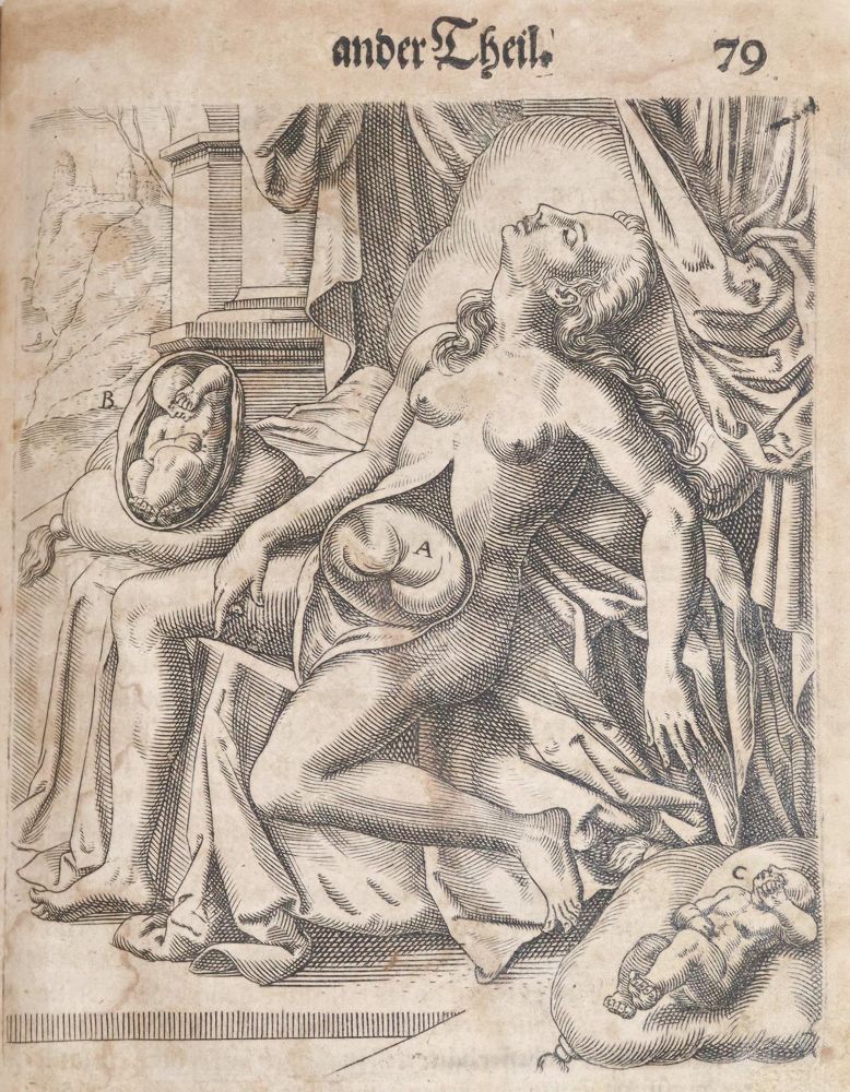 Große Abbildung Nr.3: 144-1369 Bourgeois,L.: (Medizin, Gynäkologie)