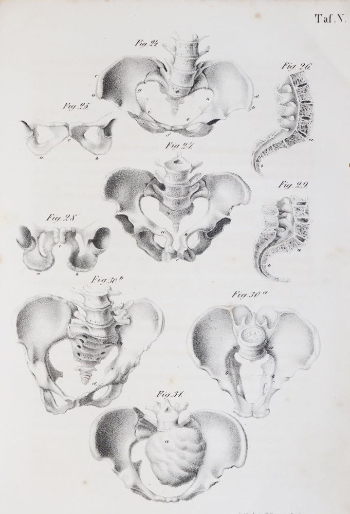 Große Abbildung Nr.2: 144-1370 Busch,D.W.H.: (Medizin, Gynäkologie)