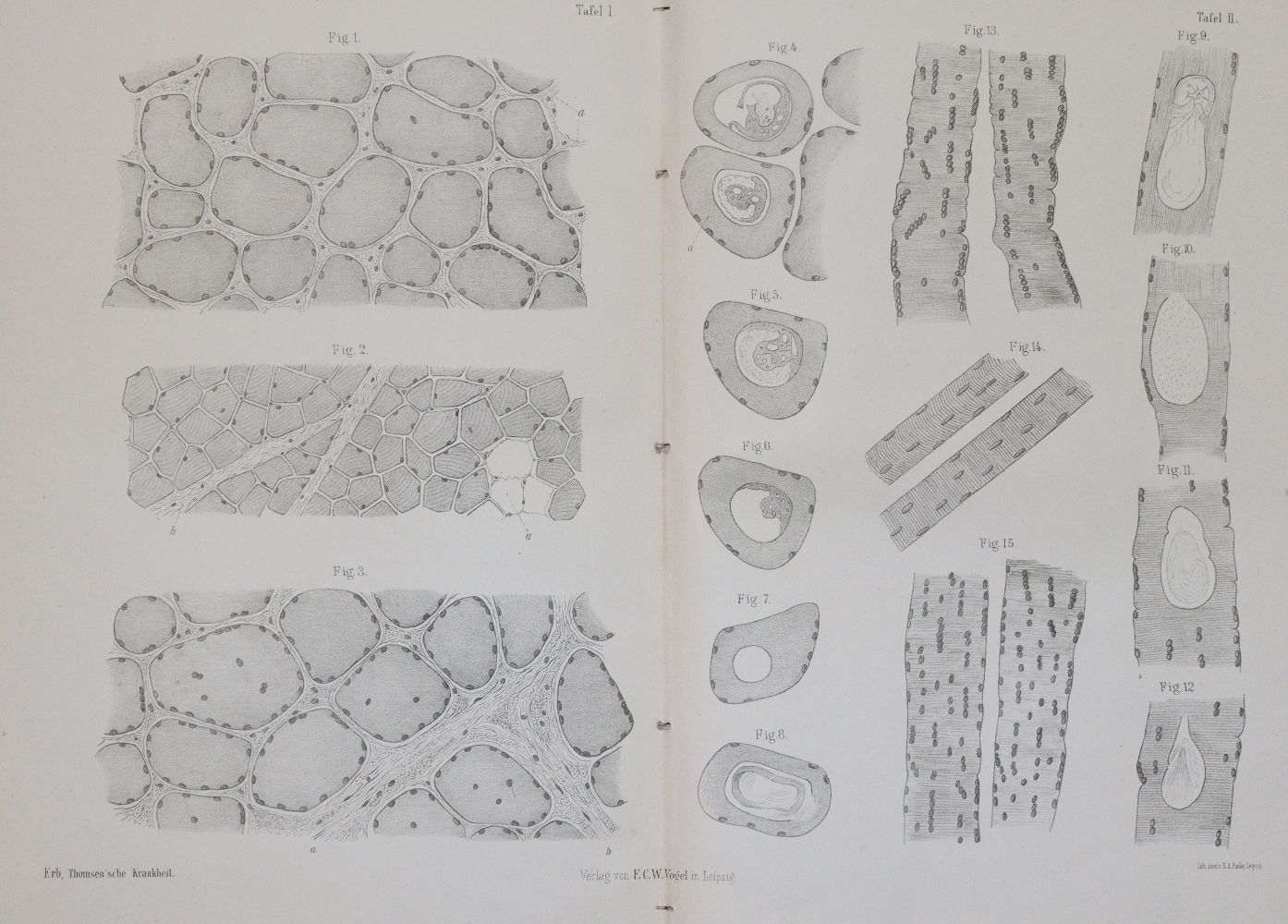 Große Abbildung Nr.13: 144-1372 Siebold,E.C.J.v.: (Medizin, Gynäkologie)