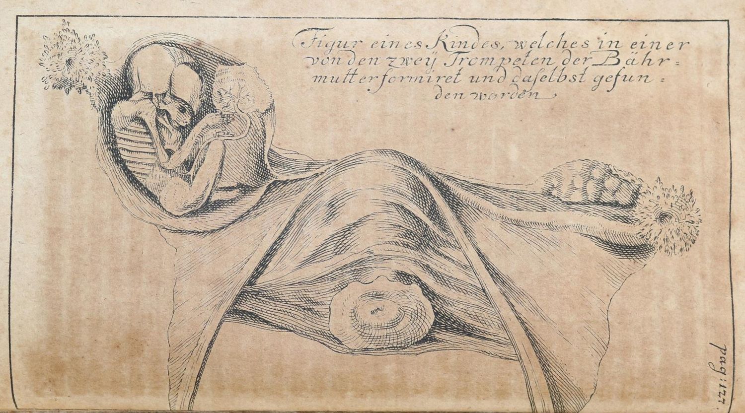 Große Abbildung Nr.2: 144-1373 Timme,J.: (Medizin, Gynäkologie)