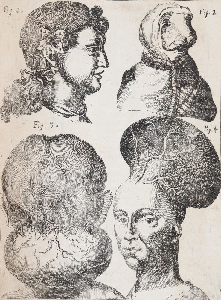 Große Abbildung Nr.4: 144-1437 Valentini,M.B.: (Medizin)