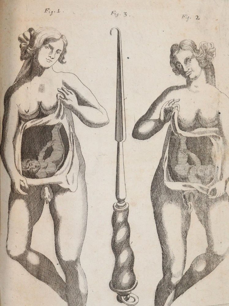 Große Abbildung Nr.6: 144-1437 Valentini,M.B.: (Medizin)
