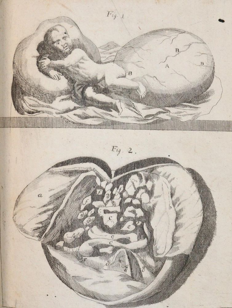 Große Abbildung Nr.7: 144-1437 Valentini,M.B.: (Medizin)