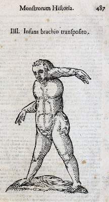 Bild Nr.2: 144-1335 Aldrovandi,U.: (Medizin)