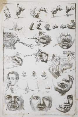 Bild Nr.4: 144-1347 Blasius,E.: (Medizin)