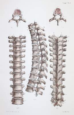 Bild Nr.1: 144-1349 Bonamy,C. u. P.Broca.: (Medizin)