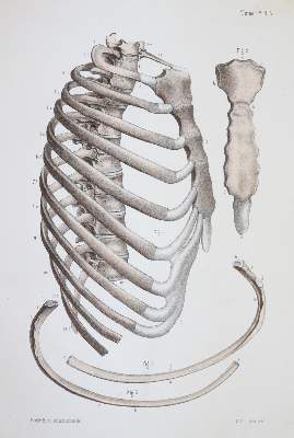 Bild Nr.3: 144-1349 Bonamy,C. u. P.Broca.: (Medizin)