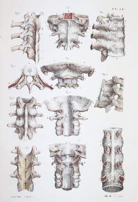 Bild Nr.4: 144-1349 Bonamy,C. u. P.Broca.: (Medizin)