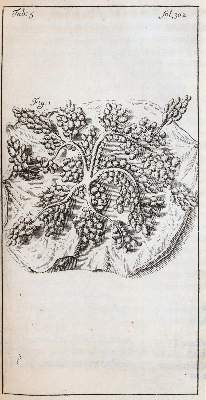 Bild Nr.4: 144-1357 Stalpart van der Wiel,C.: (Medizin, Chirurgie)