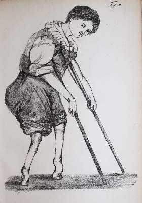 Bild Nr.5: 144-1361 Dieffenbach,J.F.: (Medizin)